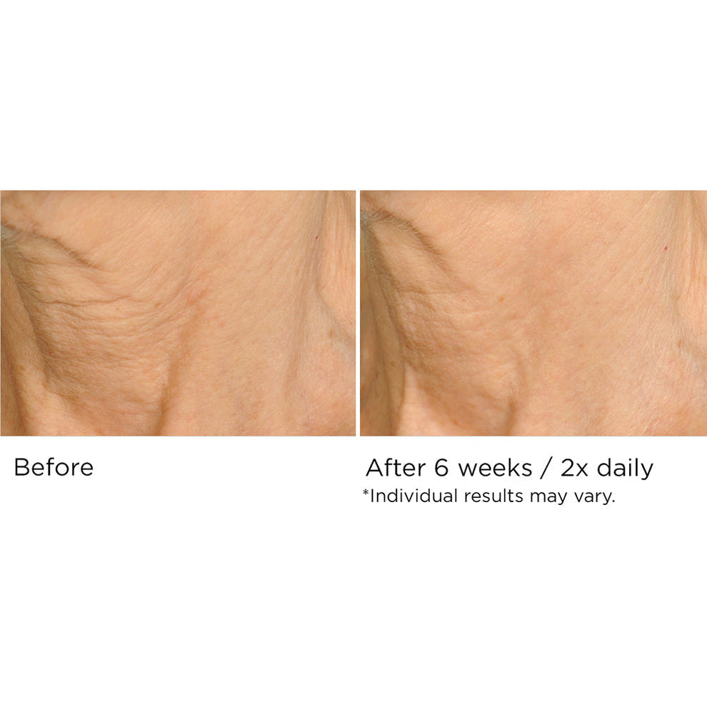 NassifMD Dermaceuticals™
Deco-Lift Neck Firming & Lifting Complex 4 fl oz/120ml