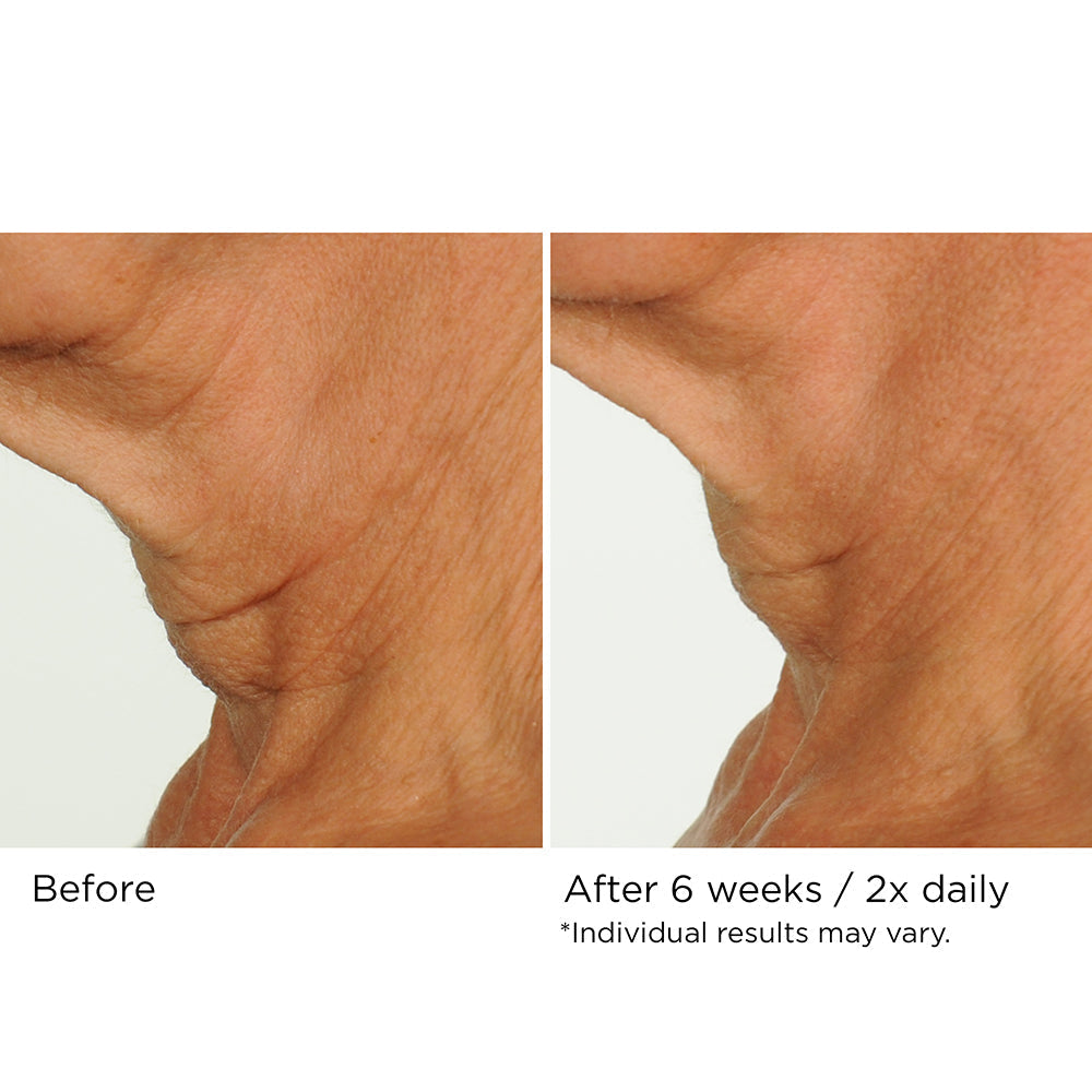 NassifMD Dermaceuticals™
Deco-Lift Neck Firming & Lifting Complex 4 fl oz/120ml
