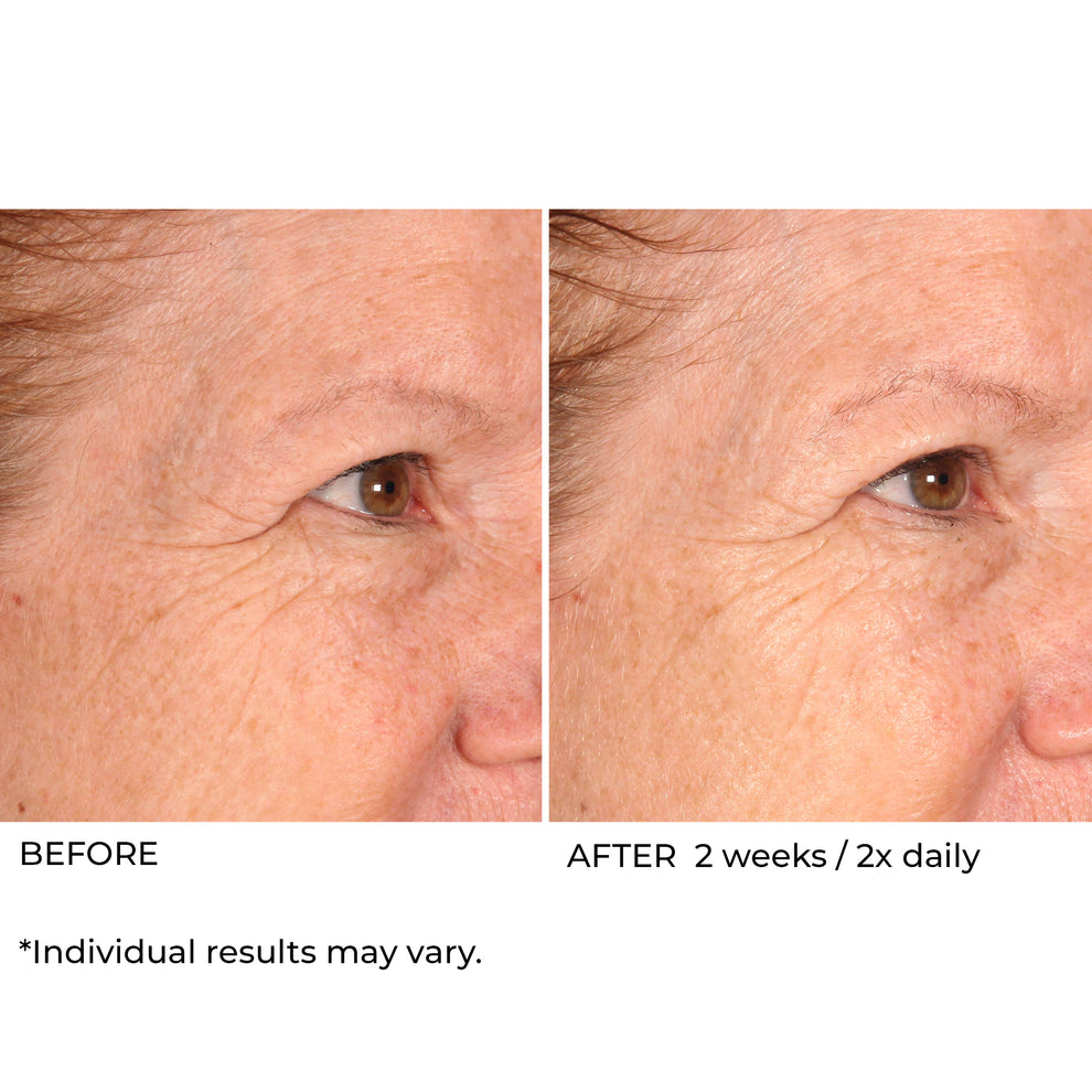 NassifMD Dermaceuticals™
Hydro-Screen® Intense Hydration Face & Body Soufflé