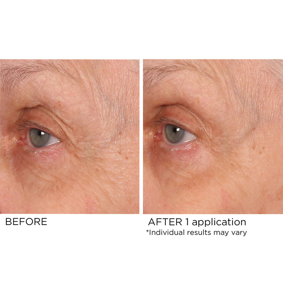 NassifMD Dermaceuticals™
Age Defying Eye Renewal Serum