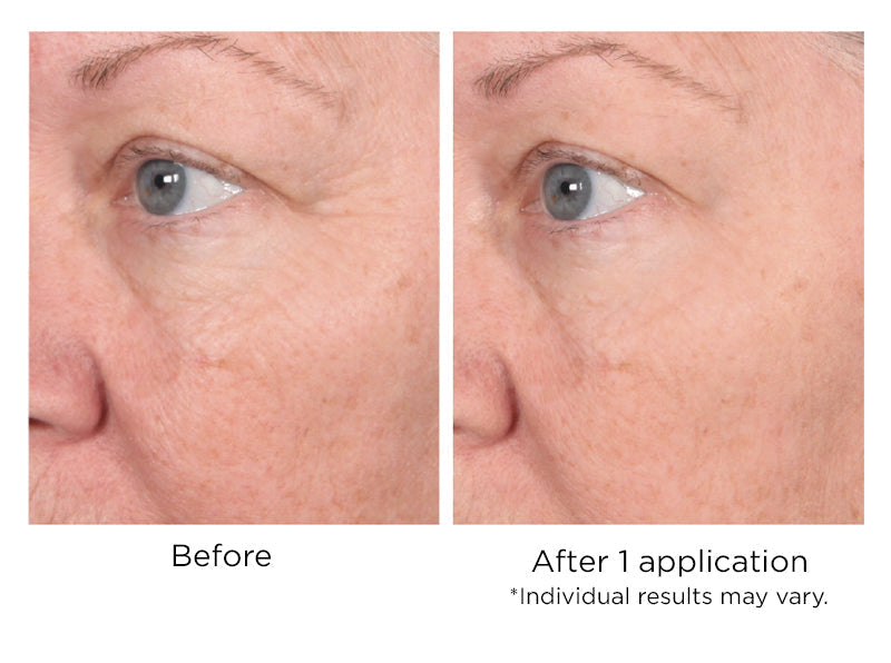 NassifMD Dermaceuticals™
Quickfix Wrinkle Reducing Serum