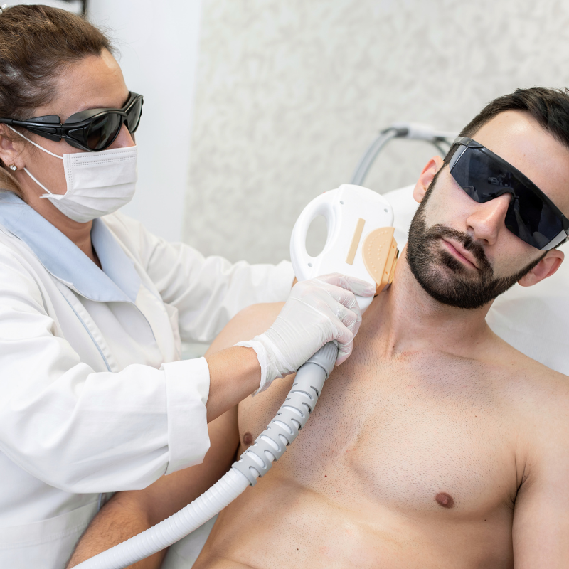 Laser hair hot sale removal for men