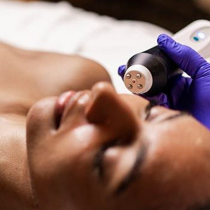 Oxygeneo 3 in 1 Super Facial W. RF (Skin Tightening)