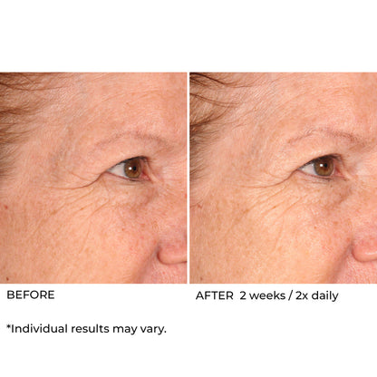 NassifMD Dermaceuticals™

Hydro-Screen® Intense Hydration Face & Body Soufflé