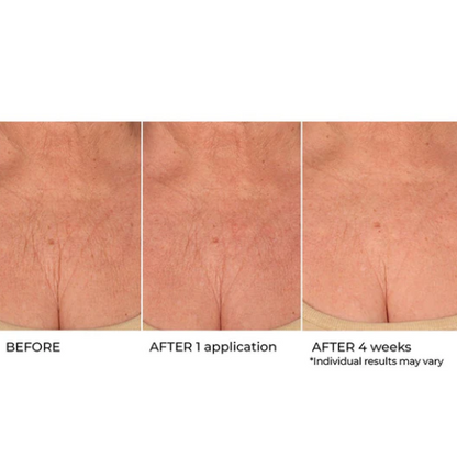 NassifMD Canada

Age Defying Neck & Décolleté Serum