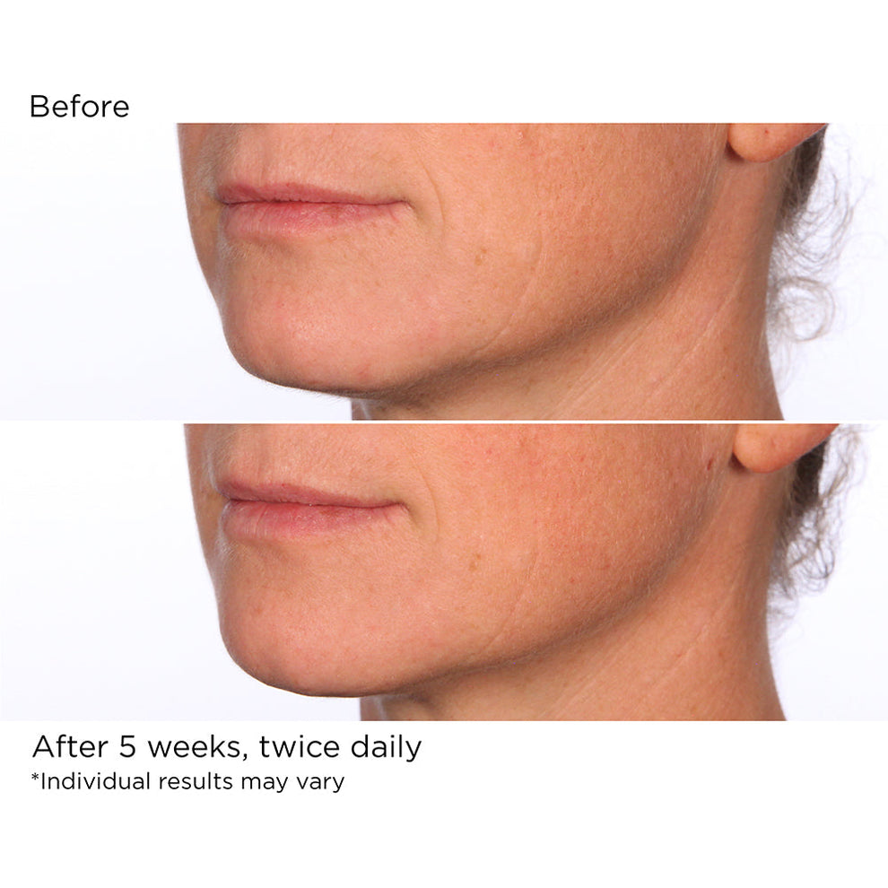 NassifMD Dermaceuticals™

Hydro-Screen Serum