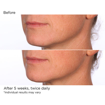 NassifMD Dermaceuticals™

Hydro-Screen Serum