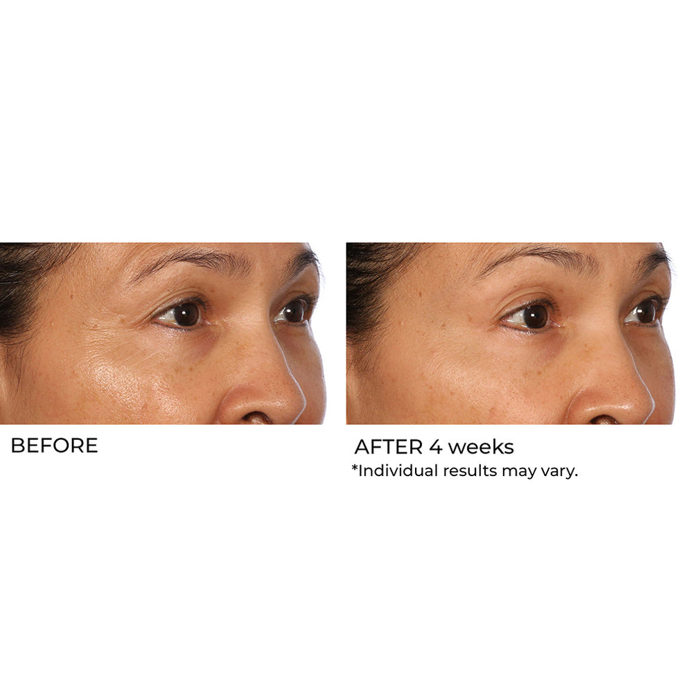 NassifMD Dermaceuticals™

Hydro-Gel