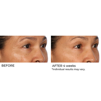 NassifMD Dermaceuticals™

Hydro-Gel