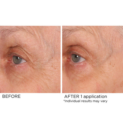 NassifMD Dermaceuticals™

Age Defying Eye Renewal Serum