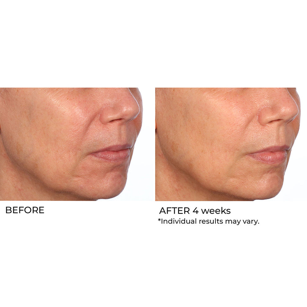 NassifMD Dermaceuticals™

Hydro-Gel