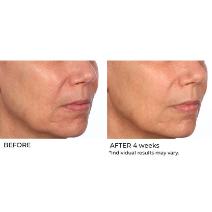 NassifMD Dermaceuticals™

Hydro-Gel