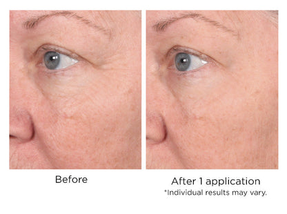 NassifMD Dermaceuticals™

Quickfix Wrinkle Reducing Serum