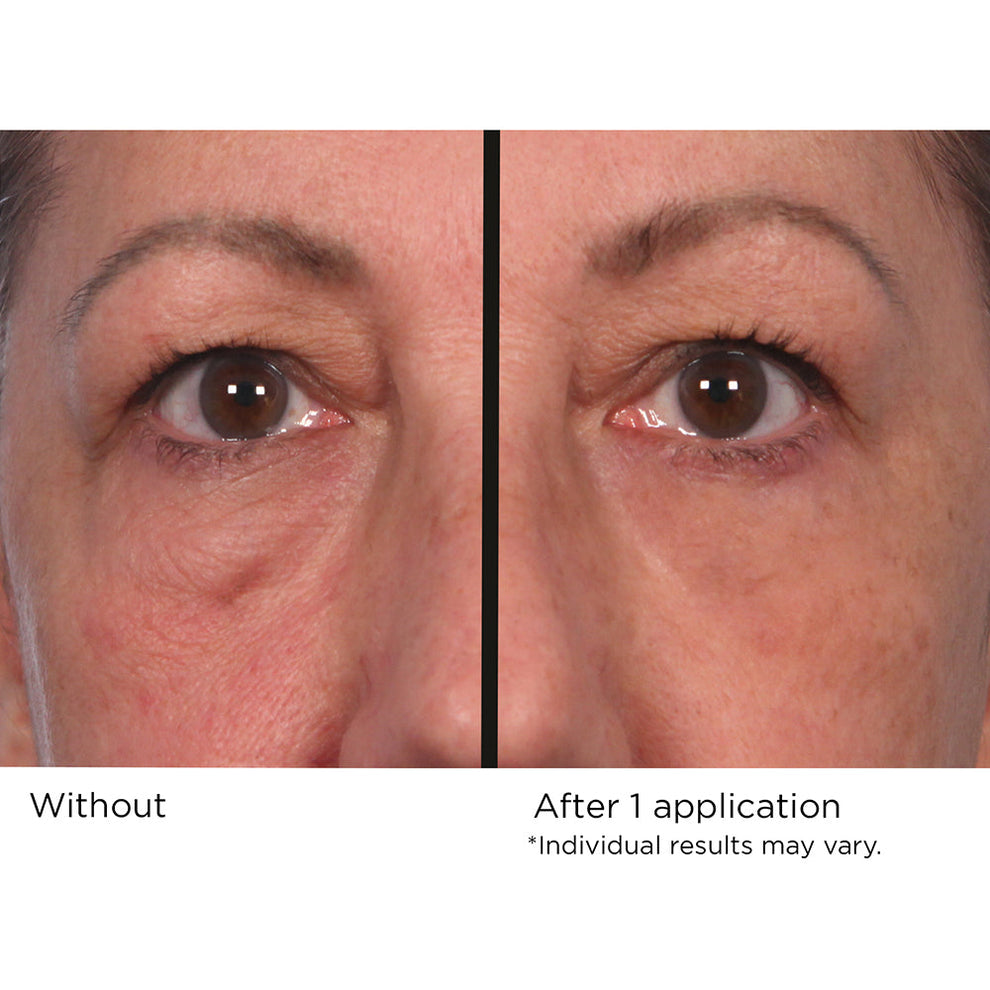 NassifMD Dermaceuticals™

Quickfix Wrinkle Reducing Serum
