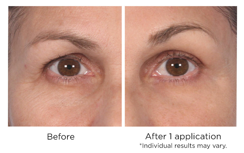 NassifMD Dermaceuticals™

Quickfix Wrinkle Reducing Serum