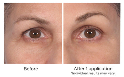 NassifMD Dermaceuticals™

Quickfix Wrinkle Reducing Serum