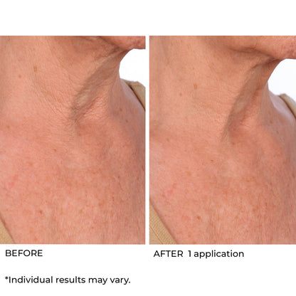 NassifMD Dermaceuticals™

Hydro-Screen® Intense Hydration Face & Body Soufflé