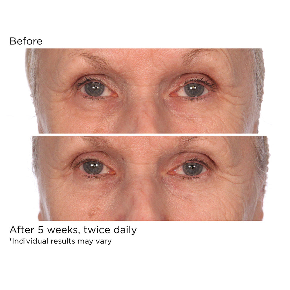 NassifMD Dermaceuticals™

Hydro-Screen Serum