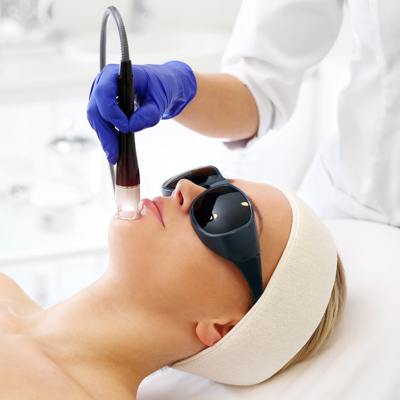 Chin Laser Hair Removal - Women