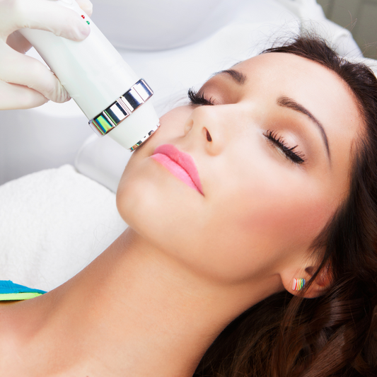 Full Face Acne Laser
