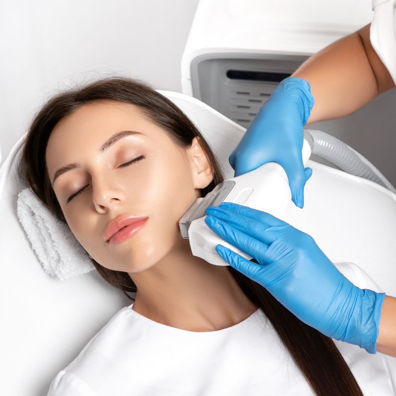 Full Face Laser Hair Removal - Women