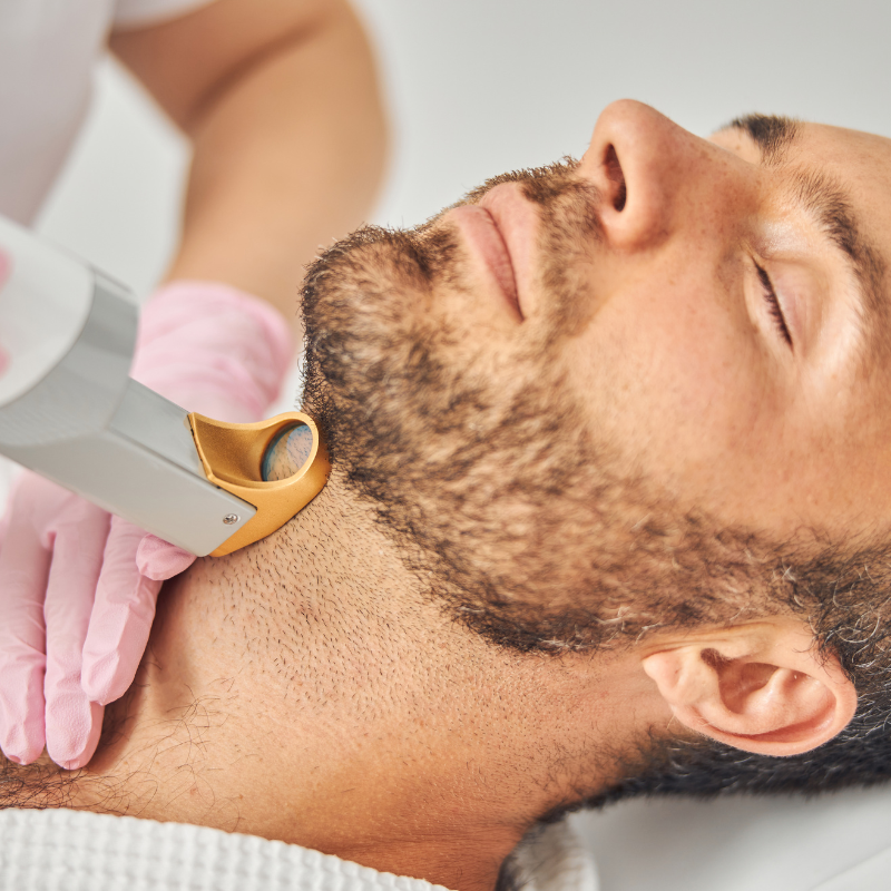 Jawline Laser Hair Removal - Men