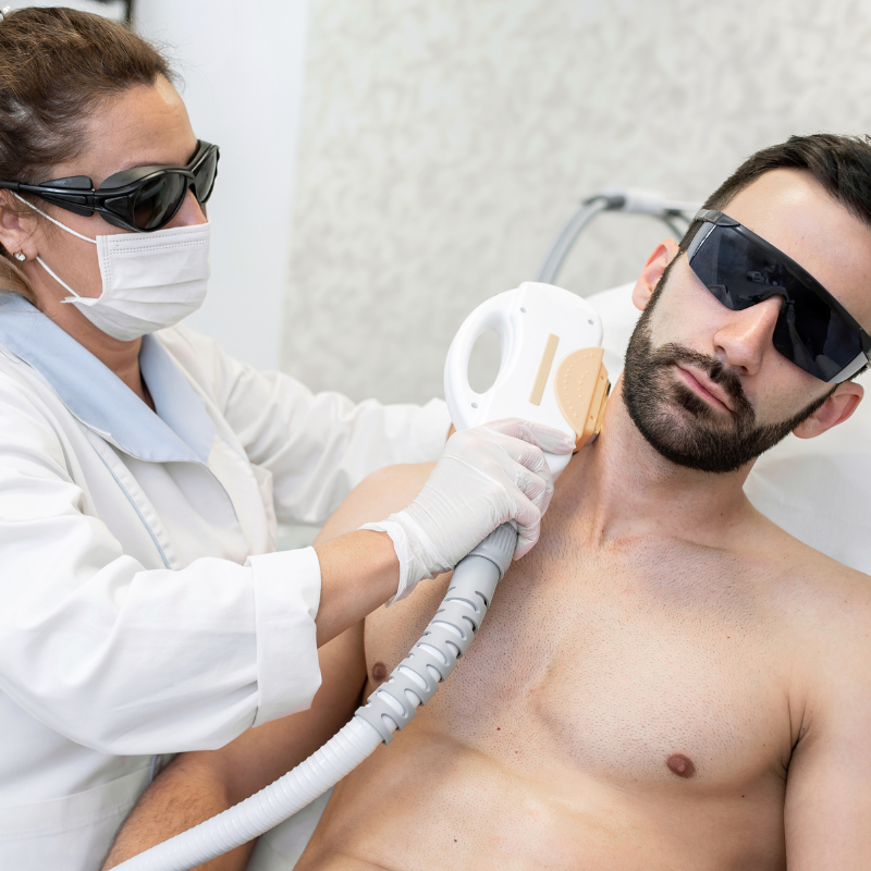 Nape Laser Hair Removal - Men