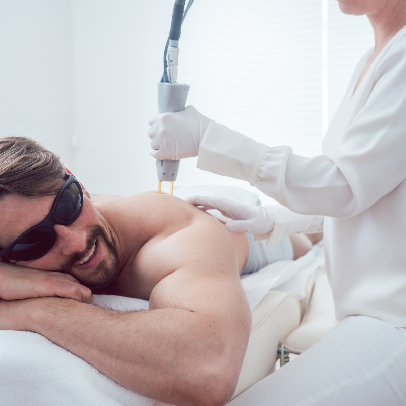 Shoulders Laser Hair Removal - Men