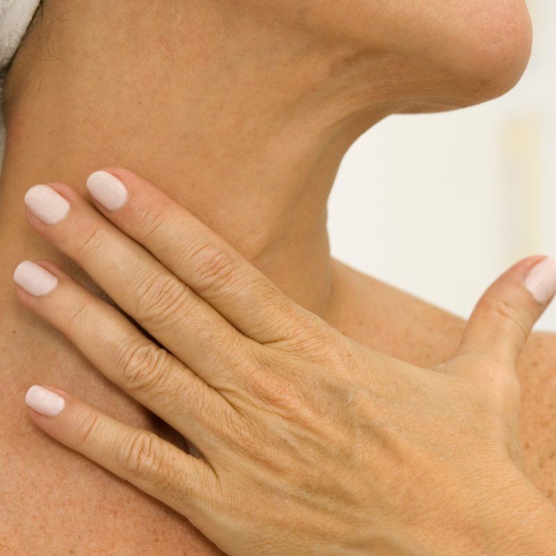 Neck Broken Capillaries Laser Treatment